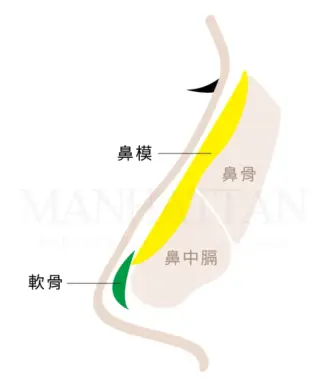 柯安達 隆鼻講解 軟骨