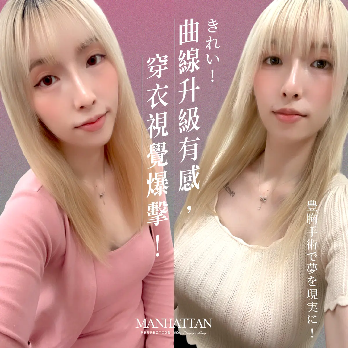 鄧儷婷 隆乳 1200x1200 01