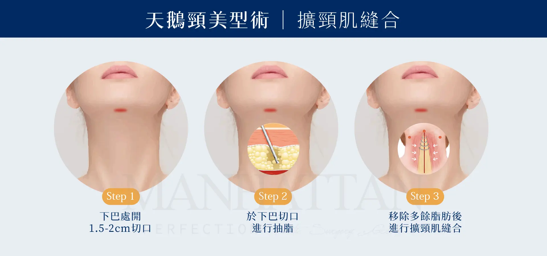 ALL 天鵝頸 擴頸肌