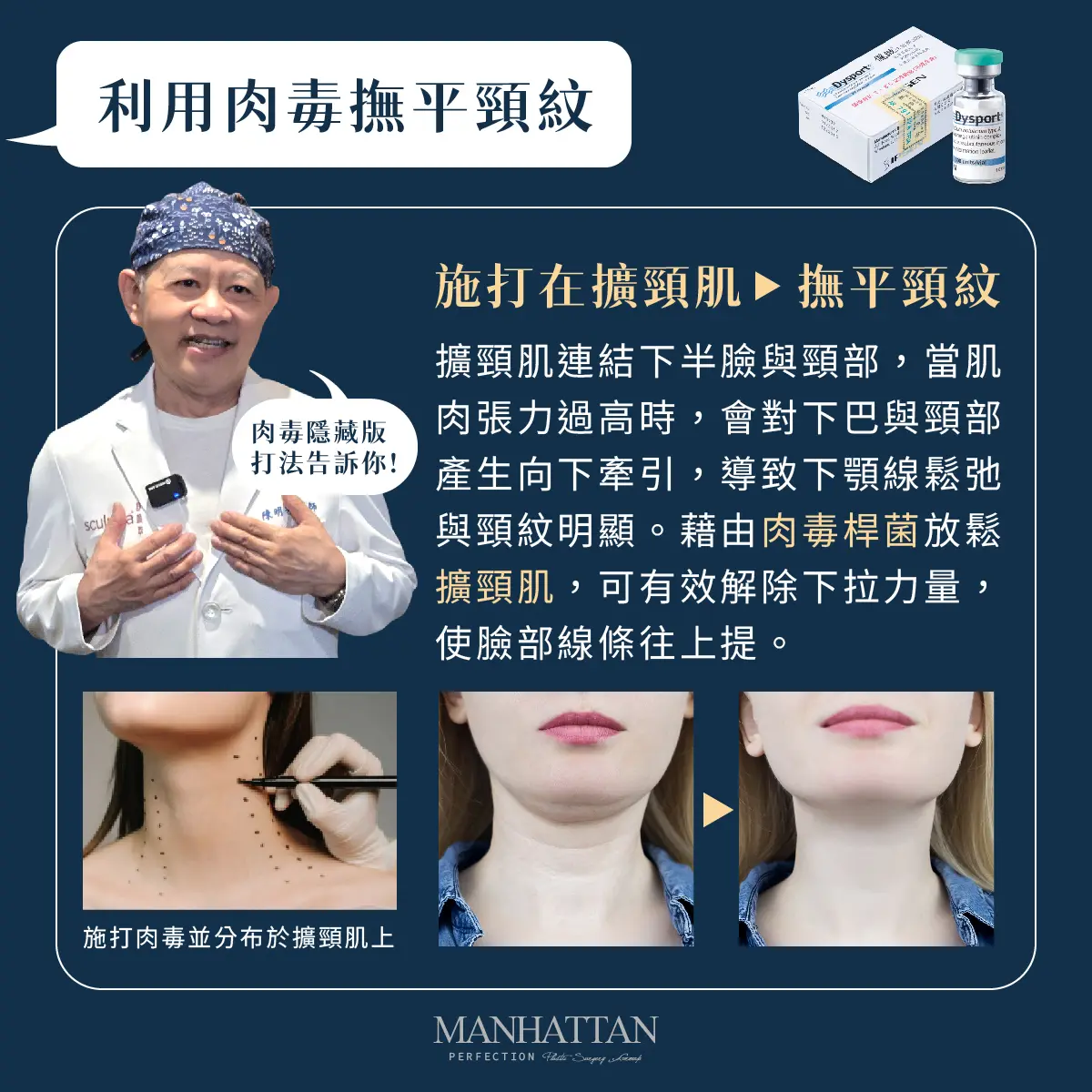 天鵝頸 微整 1200x1200 04 1