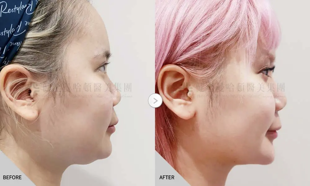 張瓅勻 天鵝頸 02