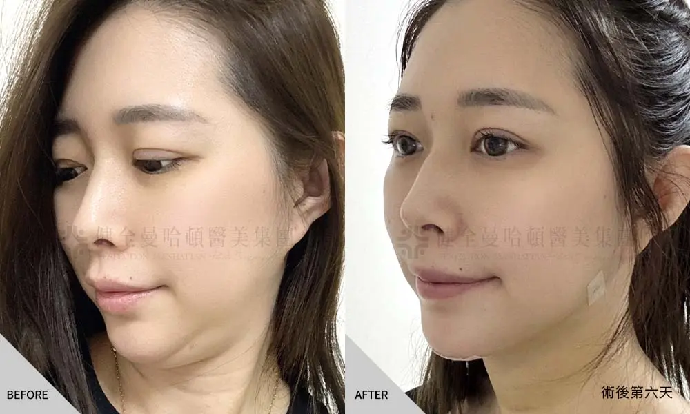 林淑慧 天鵝頸 03 1