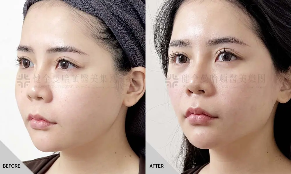 蕭佾佳 美特拉 02