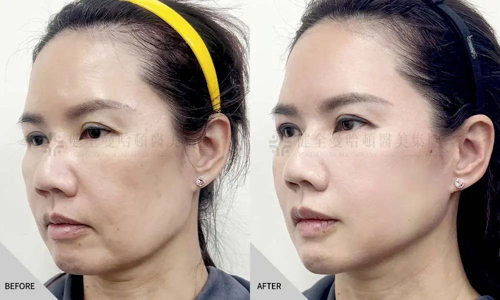 陳嬿竹 筋膜拉提 02