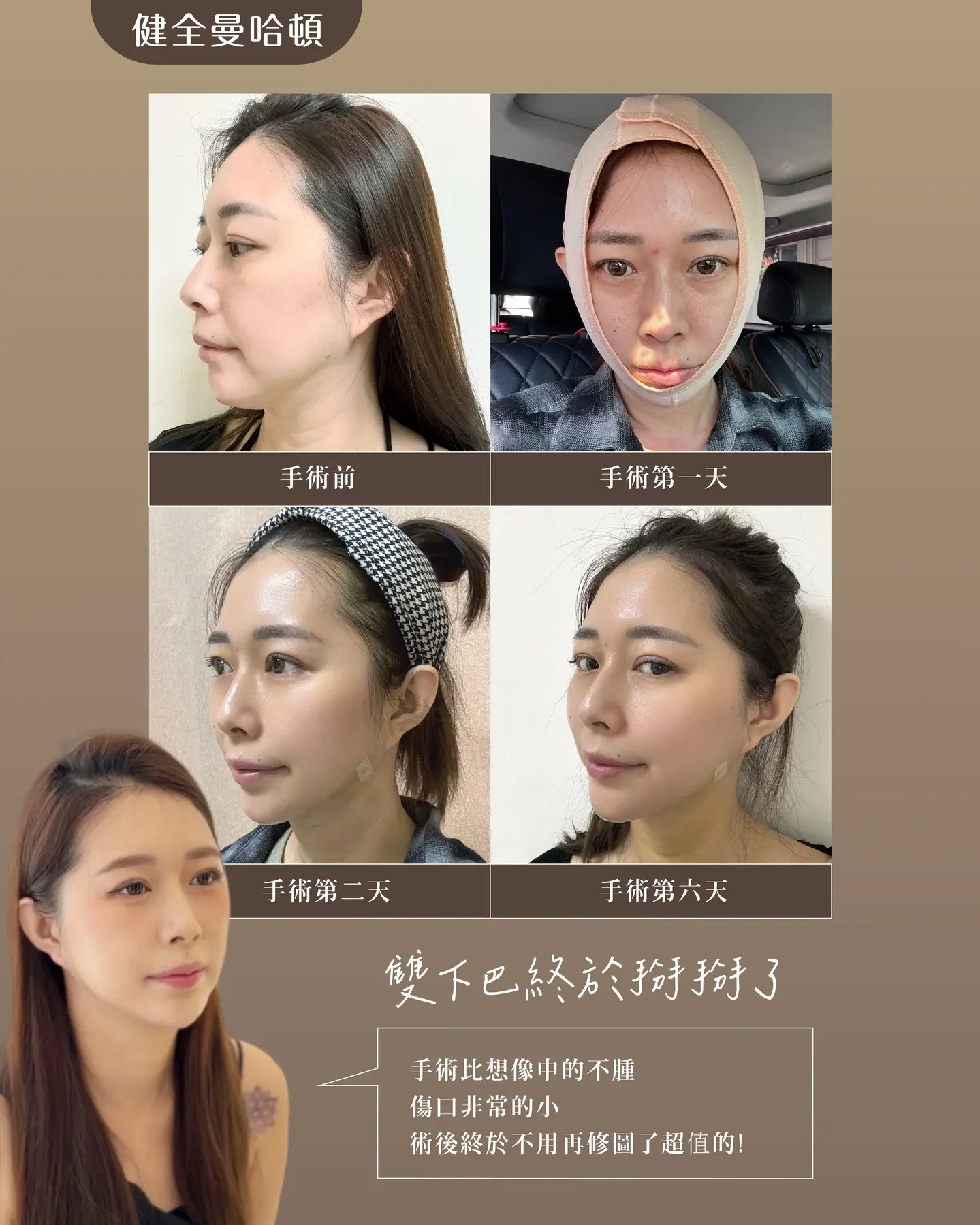 588744657 18168727738378146 1251810020356038492 N