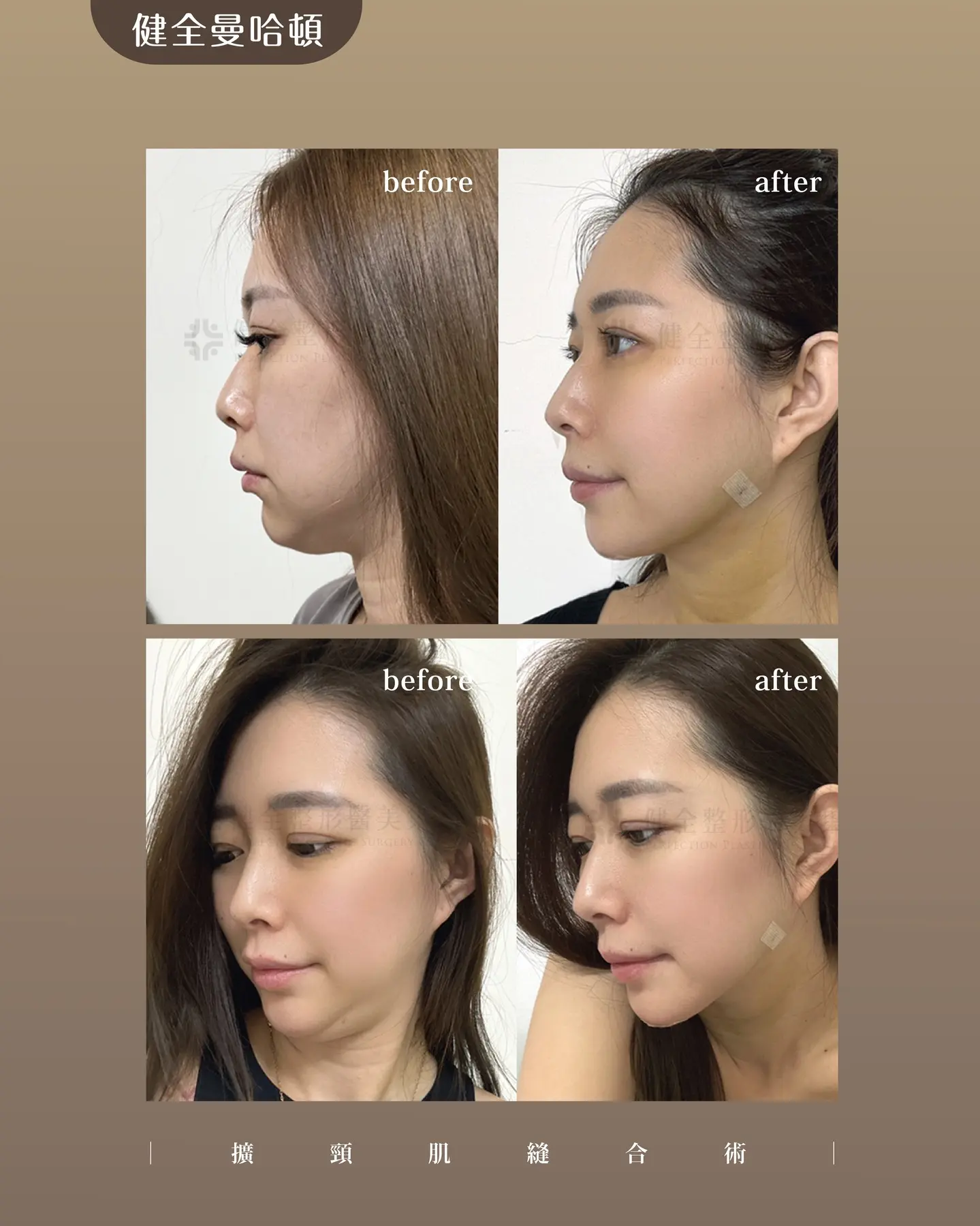 589902312 18168727729378146 2882080796789411812 N