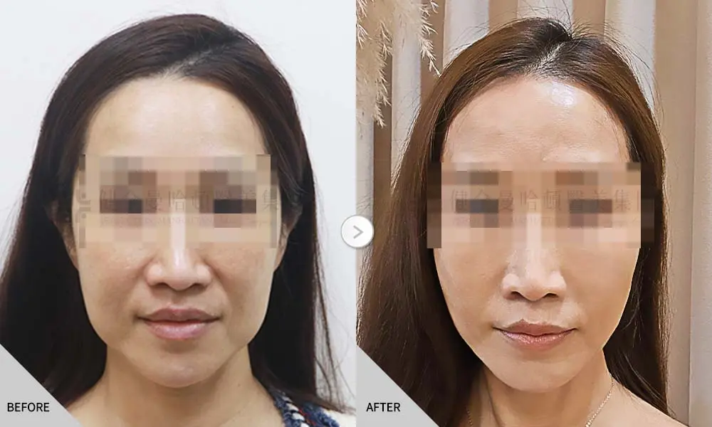 首爾女神 筋膜拉提 01