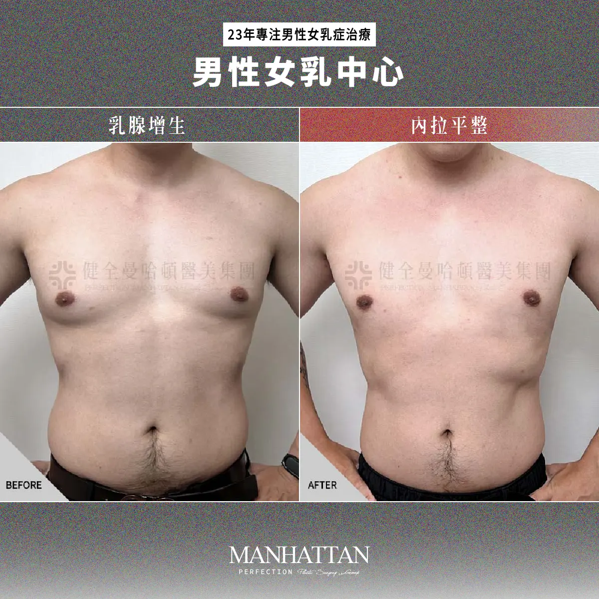 BA 黃立維 男乳 1200x1200 02