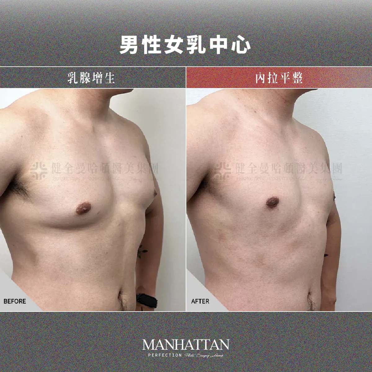 BA 黃立維 男乳 1200x1200 03