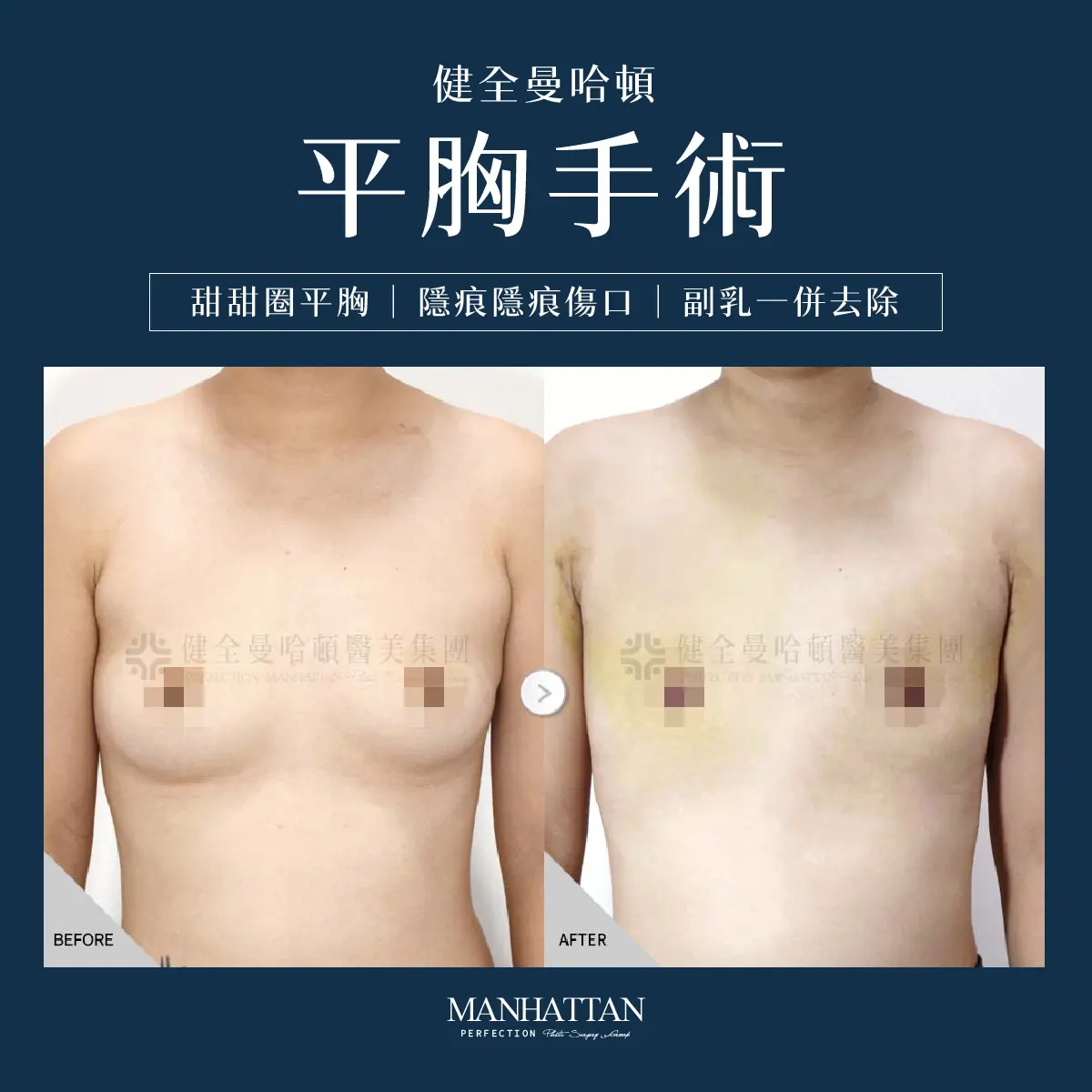 謝馥如 平胸 1200x1200 01 複本 2