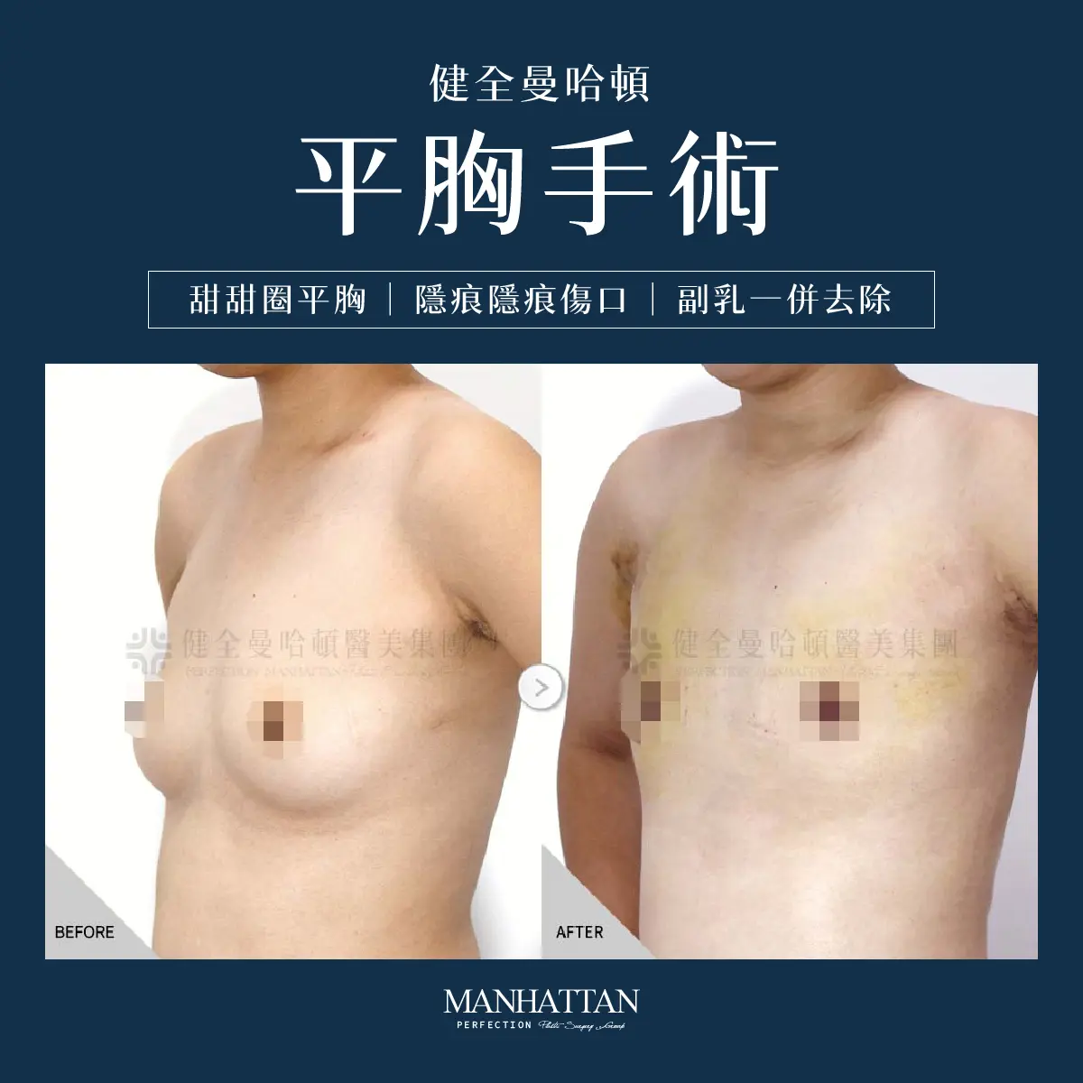 謝馥如 平胸 1200x1200 02 複本 2