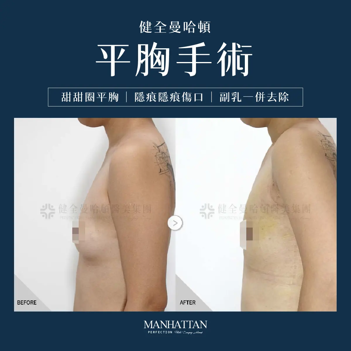 謝馥如 平胸 1200x1200 02 複本 3