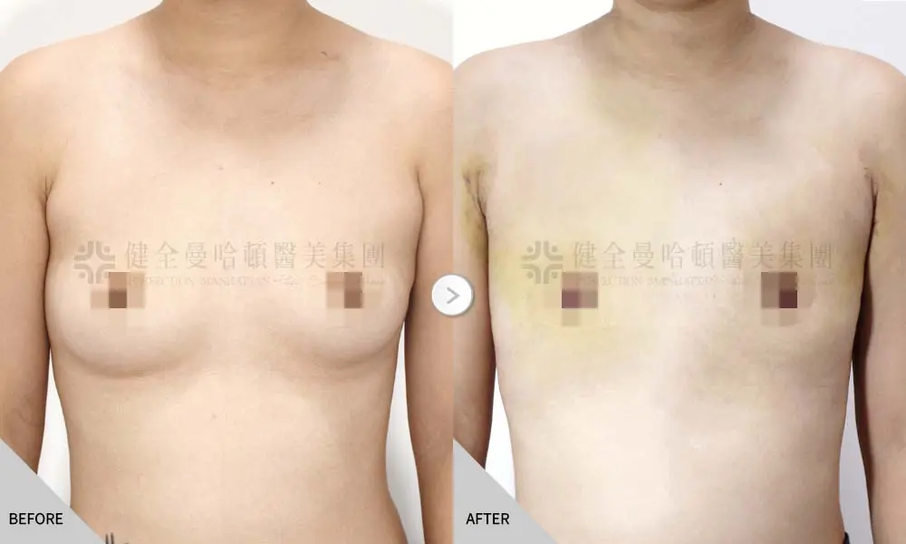 謝馥如 平胸正規 01