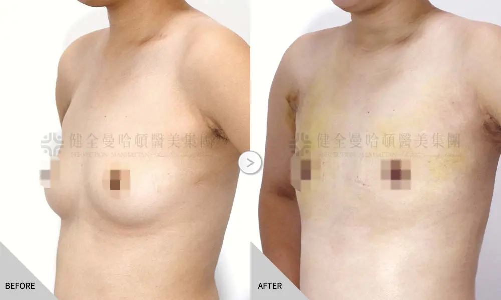 謝馥如 平胸正規 02