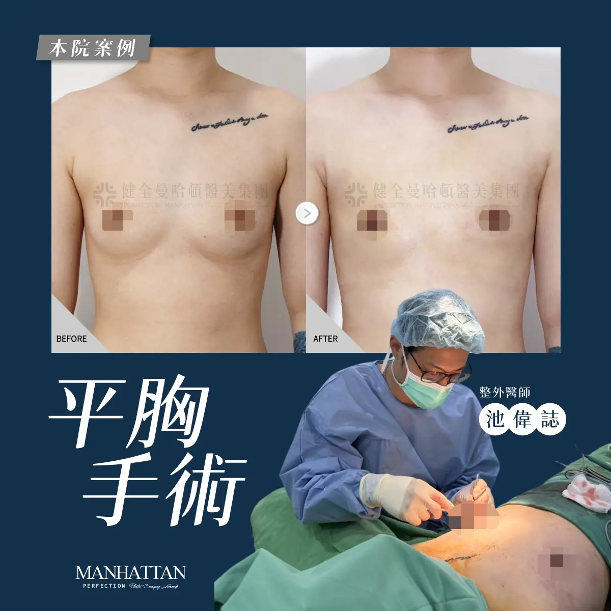 鍾欣芸 平胸 1200x1200 01