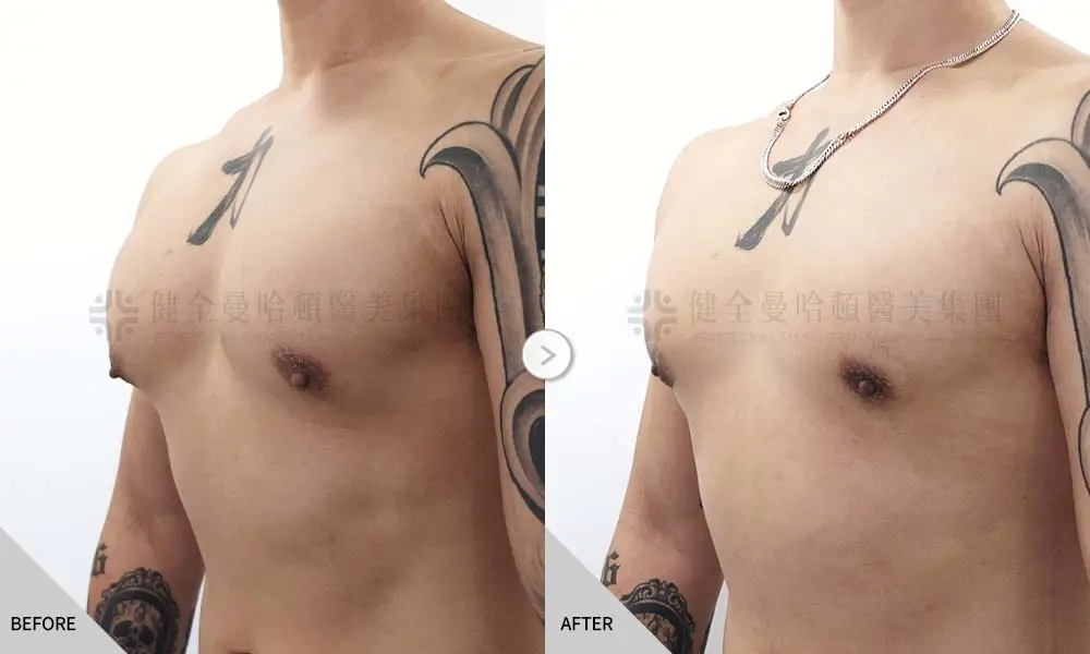 20260727 005